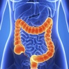 Colon Cancer:Constipation,Health Diet and Hemorrhoids