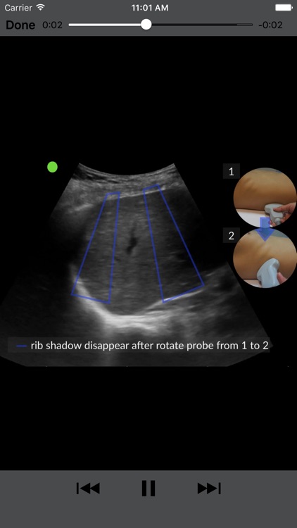 RESUS Ultrasound LITE screenshot-2