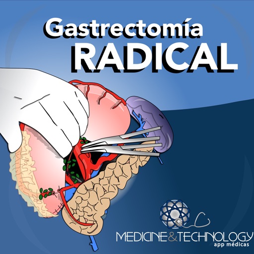 iGastrectomy icon