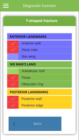Acetabular Diagnosis Tool screenshot
