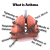 Asthma 101: Prevention Tips and Treatment Tutorial