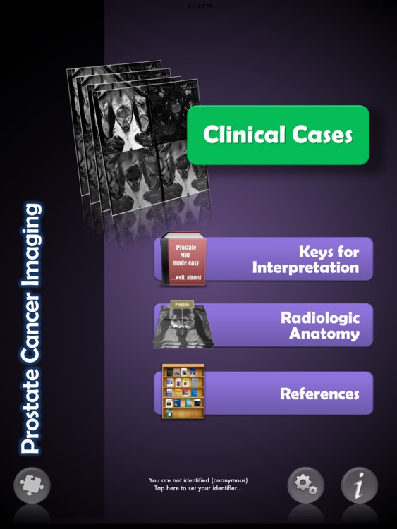 Prostate Cancer Imaging