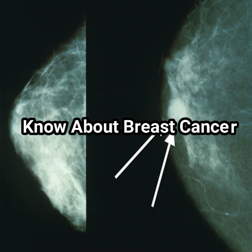 Know About Breast Cancer icon