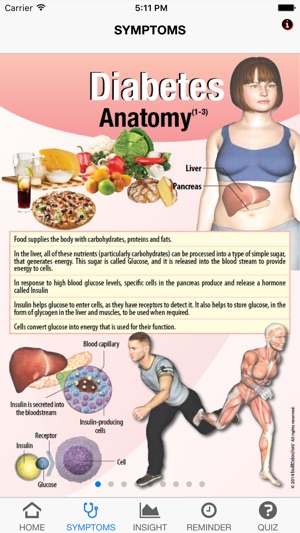 Signs & Symptoms Diabetes(圖2)-速報App