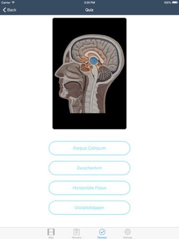 Anatomie & Physiologie Animationen screenshot 3