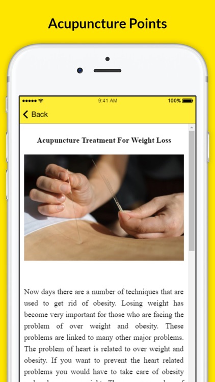 Chinese Acupuncture Therapy - Treatment For Weight Loss