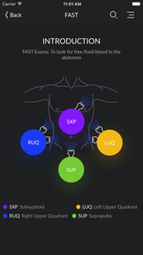 RESUS Ultrasound LITE screenshot