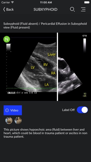 RESUS Ultrasound LITE(圖1)-速報App