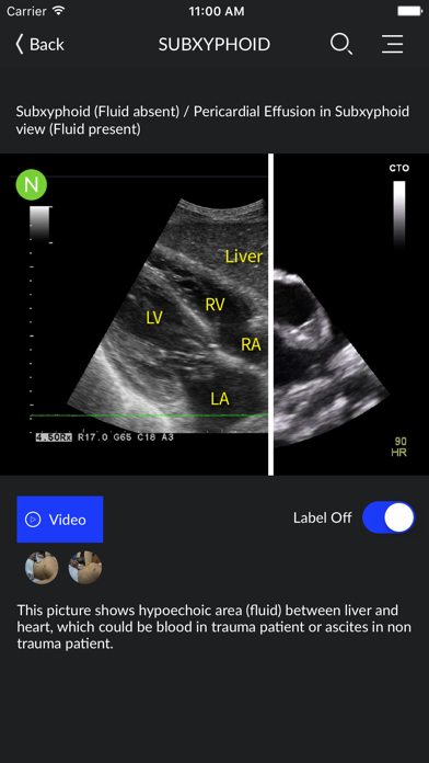 RESUS Ultrasound LITEのおすすめ画像1