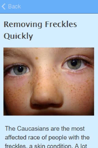 How To Get Rid Of Freckles screenshot 3