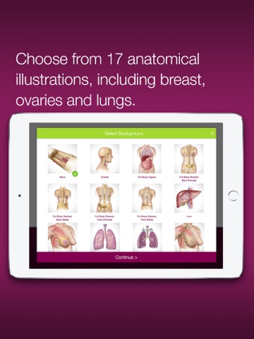 ONCsultation – Draw, Discuss & Share Medical Illustrations & Resources With Oncology Patients screenshot 2