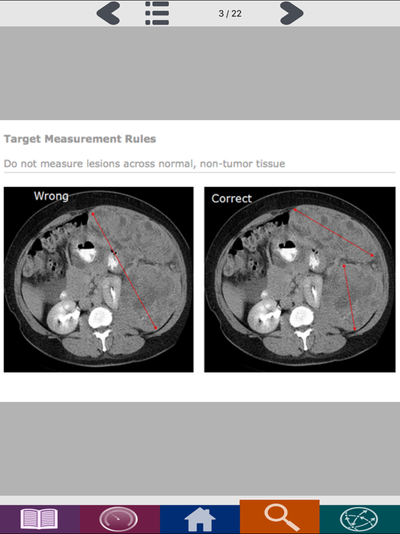 Screenshot #5 pour PAREXEL RECIST 1.1