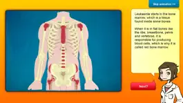 Game screenshot Cure Nadia's Cancer hack