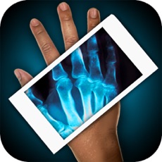 Activities of Simulator X-Ray Hand