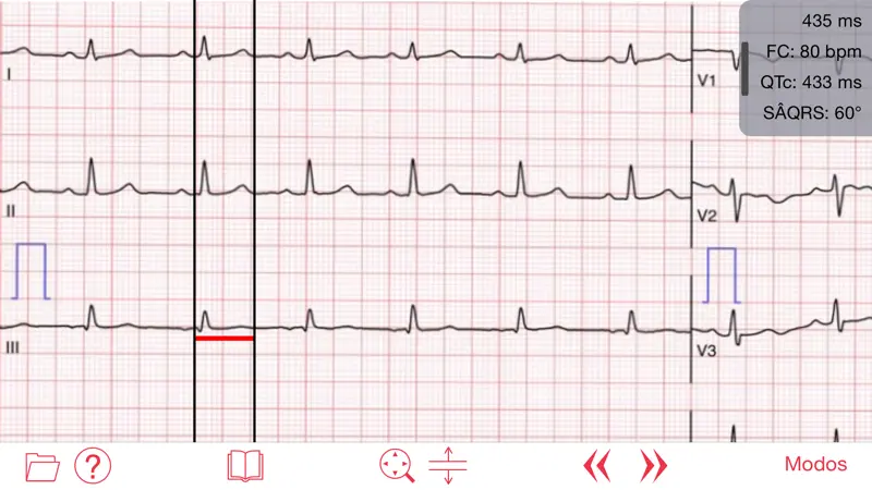 Photo EKG screenshot 3 of 4