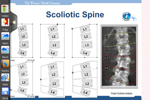 Hologic DXA screenshot 2