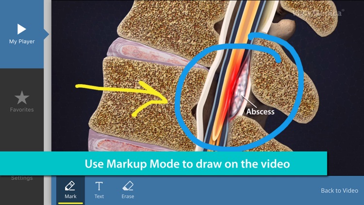 ViewMedica Patient Education Videos