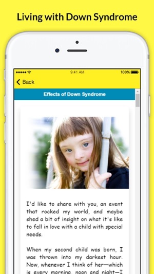 Living with Down Syndrome - Facts and Symptoms(圖3)-速報App