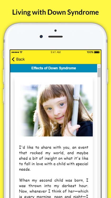 Living with Down Syndrome - Facts and Symptoms