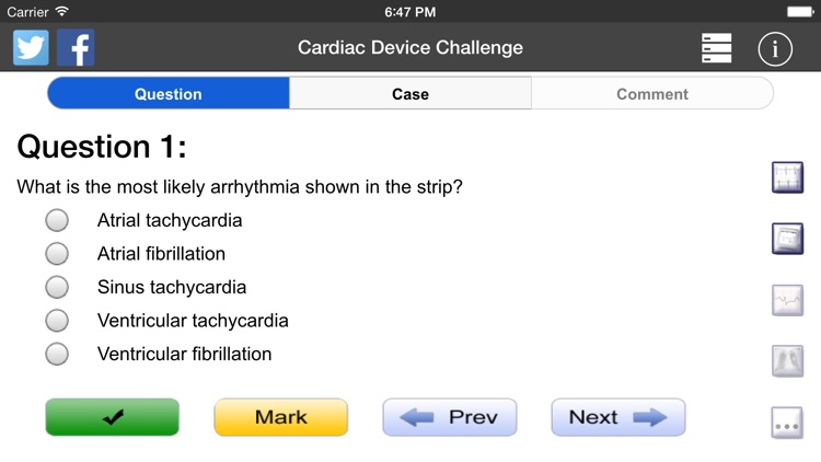 Cardiac Device Challenge PRO