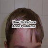 How to reduce acne problems