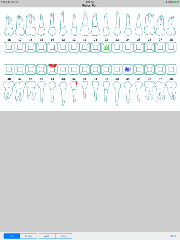 Screenshot #5 pour Plato Annotation
