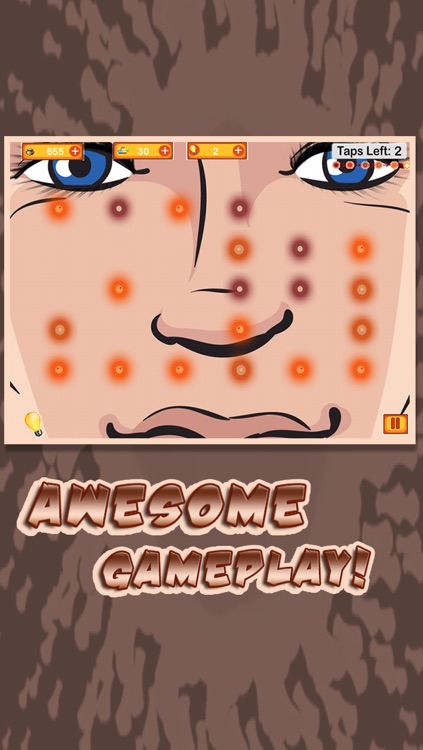 Pimple Popping : Warning Highly Explosive and a Little Gross!