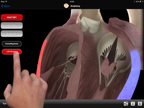 HEART MASTER Aortic Stenosis screenshot 2