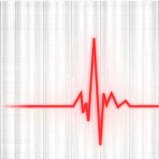 Revised Cardiac Risk Index - Lee Criteria