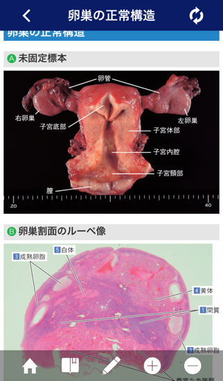 正常画像と比べてわかる病理アトラス Lite版のおすすめ画像1