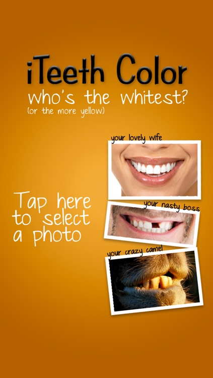 iTeeth Color : my teeth color ?