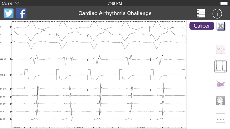 Cardiac Arrhythmia Challenge PRO screenshot-3