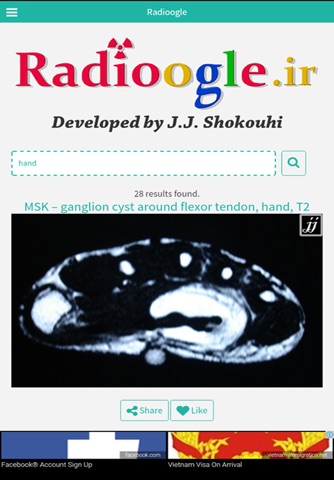 radioogle screenshot 3