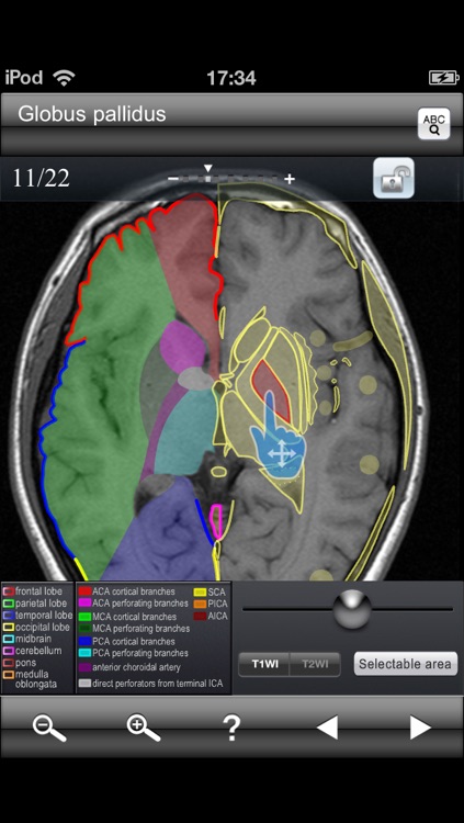 Brain MRI Sectional Walker