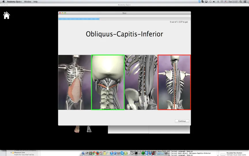 Anatomy Quiz+ iPhone Screenshot 3