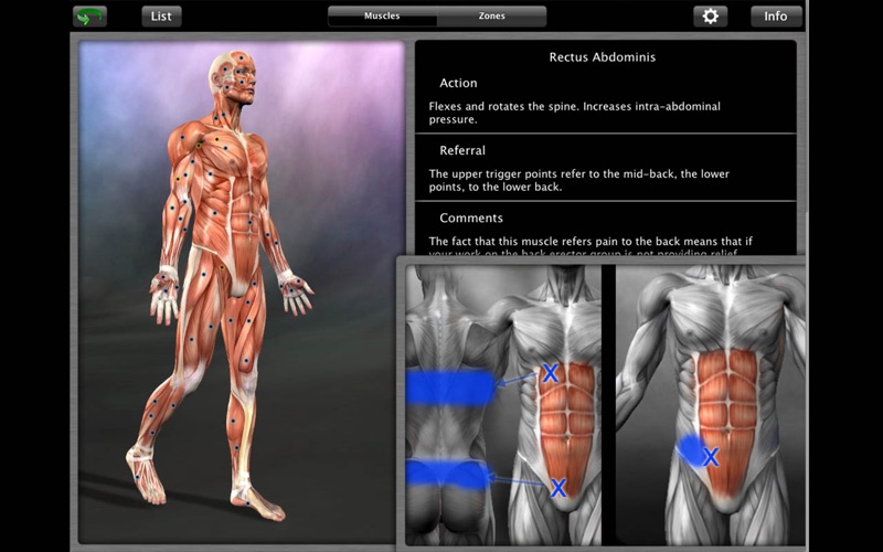 muscle trigger point anatomy problems & solutions and troubleshooting guide - 4