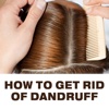 How To Get Rid Of Dandruff