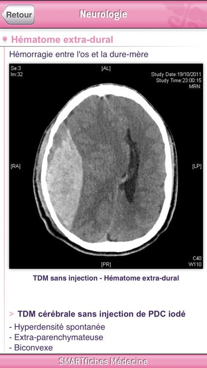 SMARTfiches Neurologie Free
