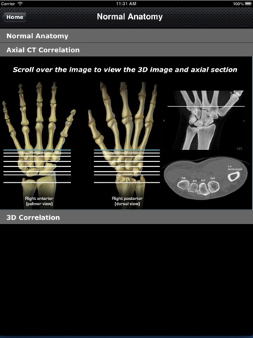 CTisus: CT of the Hand & Wrist screenshot 3