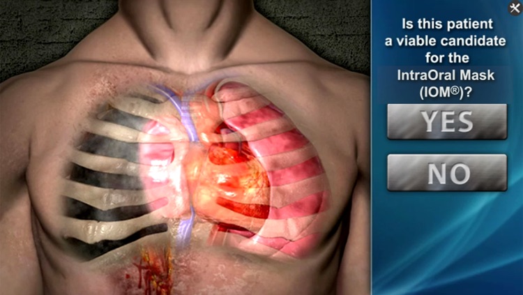 DeviceDrills: NuMask CPR IOM® screenshot-3