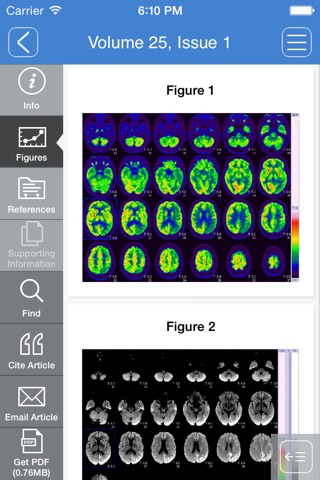 Journal of Neuroimaging screenshot 2