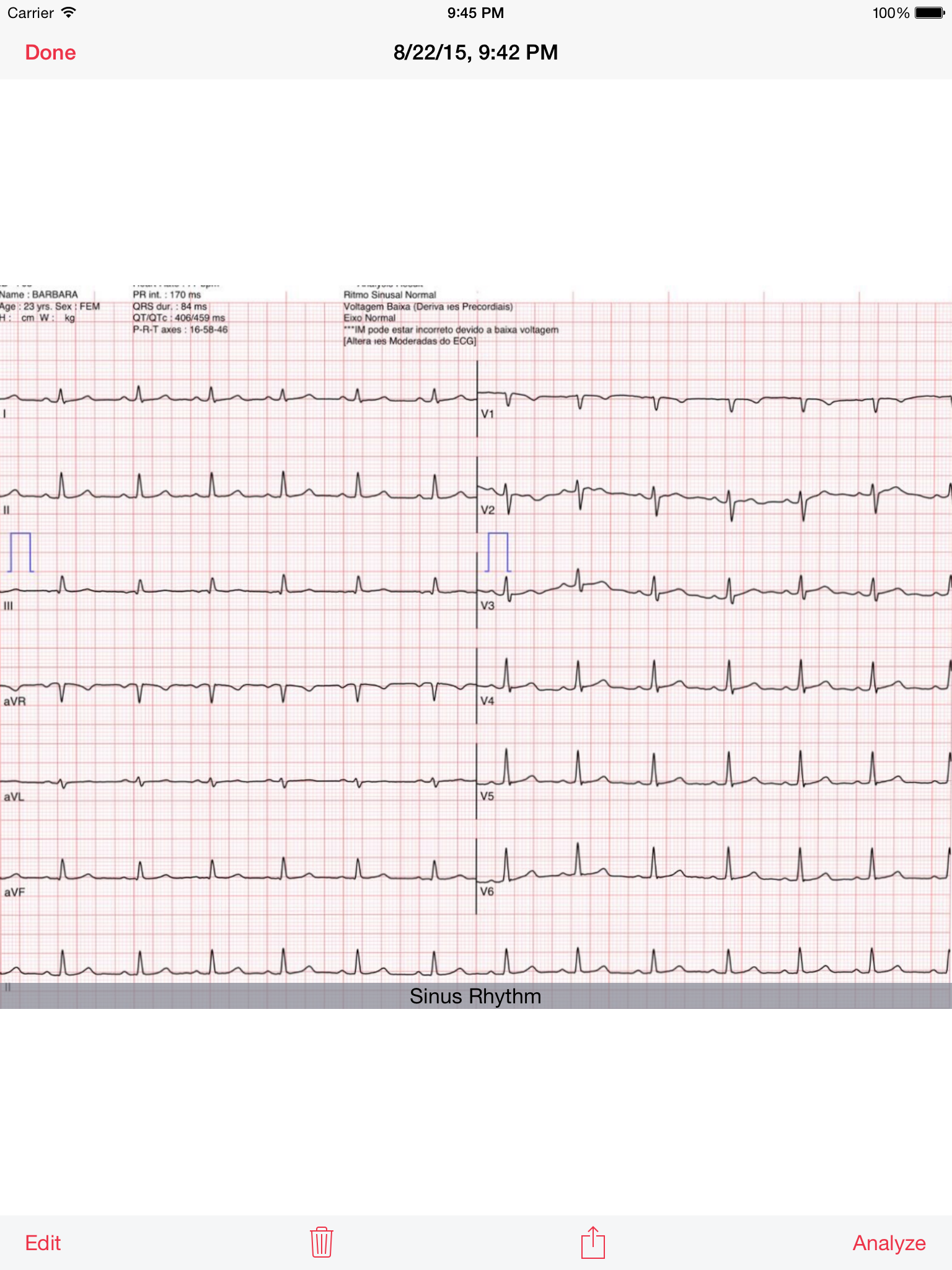 Photo EKG