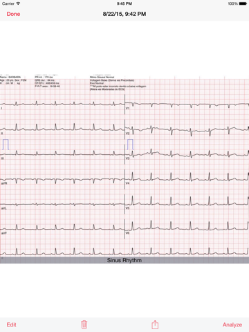 Photo EKG iPad screenshot