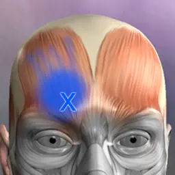Muscle Trigger Point Anatomy app icon