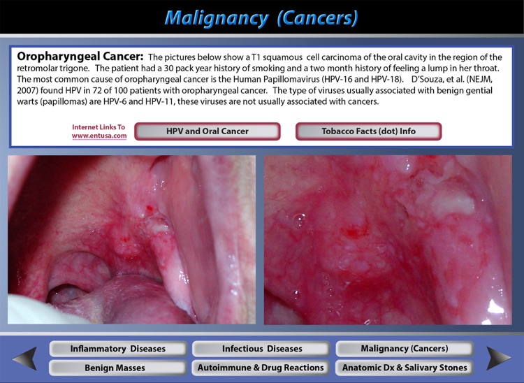 Oral Pathology