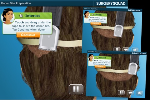 Hair Transplant - Surgery Squad screenshot 2