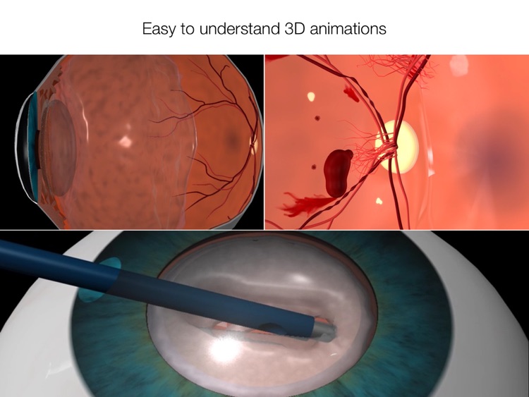Easy Eye