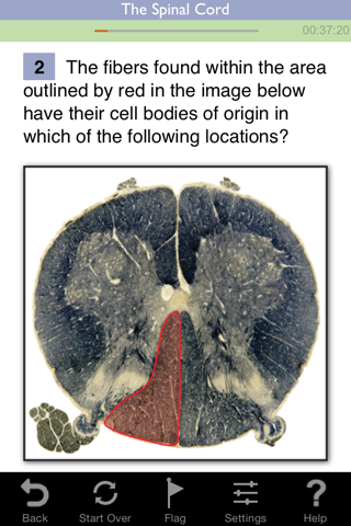 Neuroscience Lippincott's Illustrated Q&A Review screenshot 2