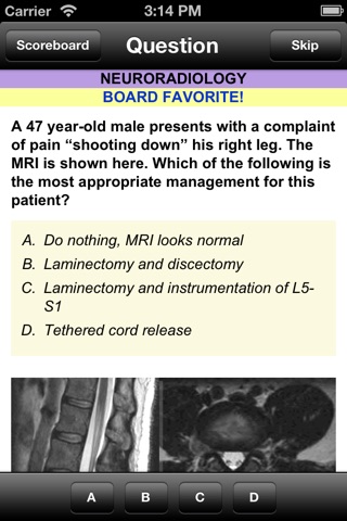 Neuro Board Review screenshot 2