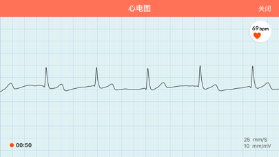 Screenshot #2 pour 橙子心电图
